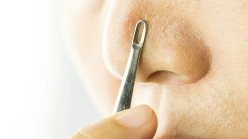 طريقة إزالة الرؤوس السوداء من الأنف