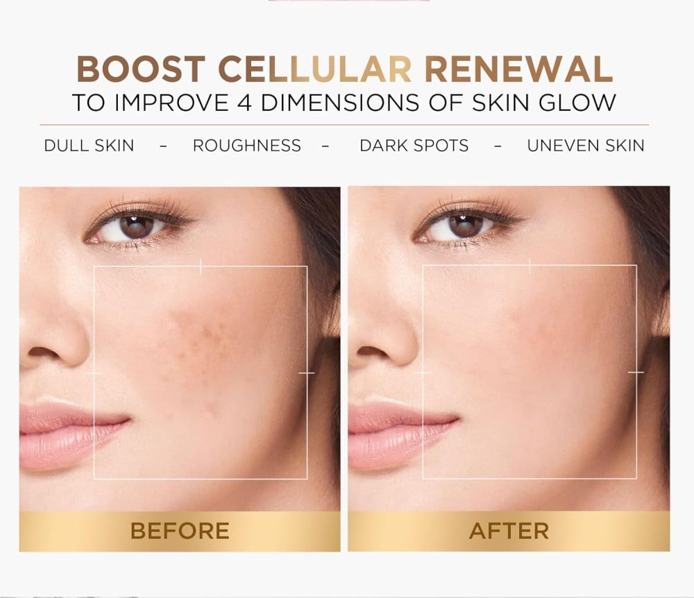 لوريال باريس تونر مقشر خلاصة الجليكوليك لإشراقة فورية - 128 مل