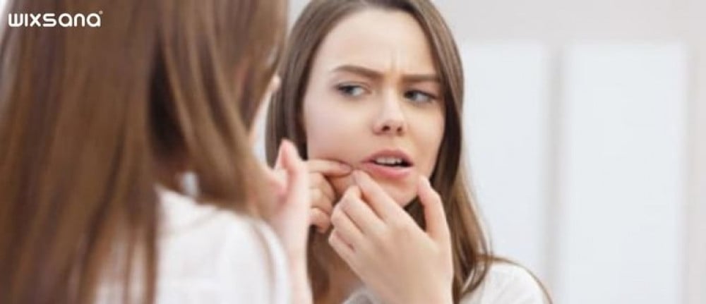 ما هي الرؤوس السوداء؟ وكيف يمكن علاجها؟