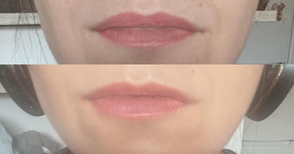 CELDYQUE  Volufiline 100%