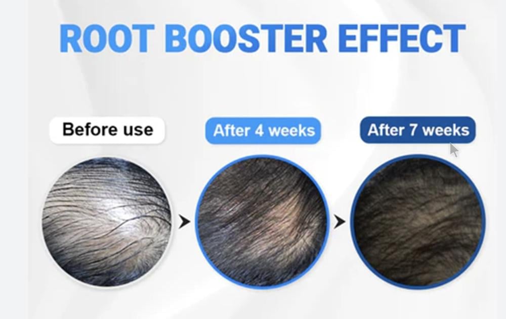 seapuri  Scalpy Hair Serum 20ml سيروم الشعر الكوري لتكثيف الشعر