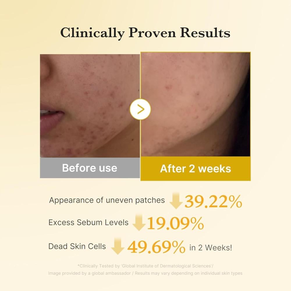 Medicube KOJIC ACID TURMERIC PAD 70pcs تونر بادز ميدكيوب بالكوجيك اسيد و الكركم ٧٠ قطنه