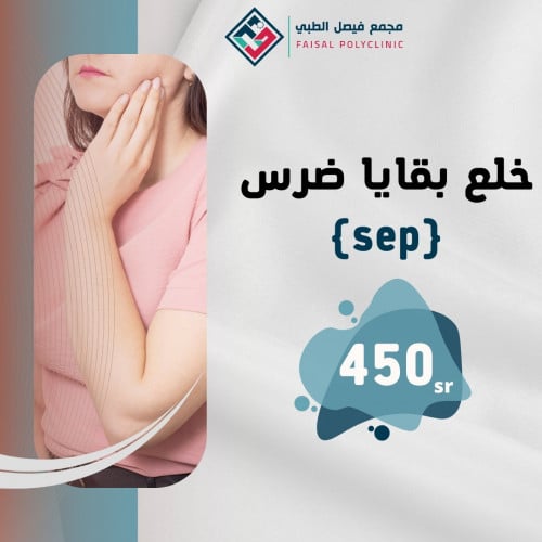 خلع بقايا ضرس sep