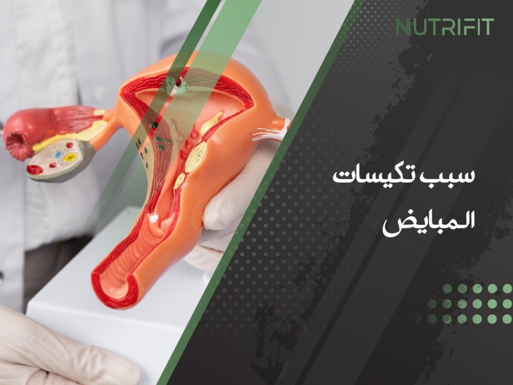 سبب تكيسات المبايض وتاثيرها على ثبات او زيادة الوزن