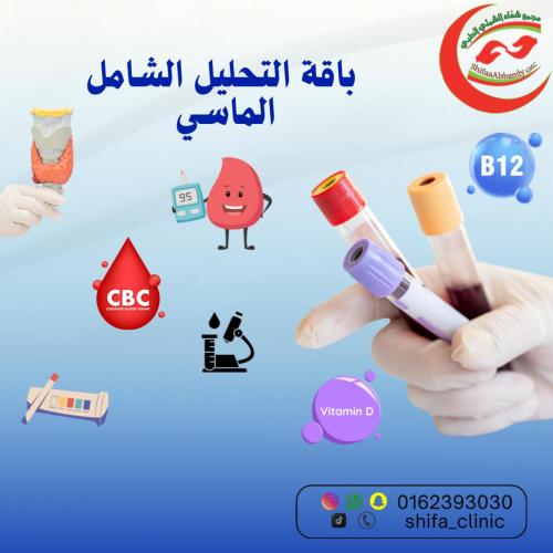 التحليل الشامل الماسي