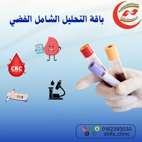 التحليل الشامل الفضي