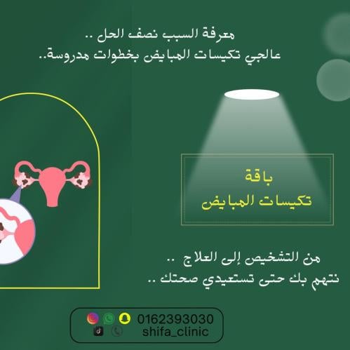 باقة تكيسات المبايض