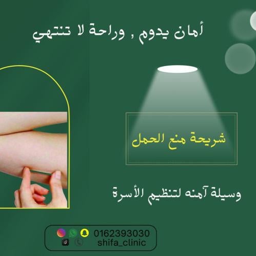 شريحة منع الحمل