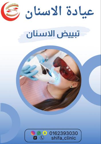 تبيض الاسنان