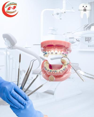 تقويم الاسنان الفك