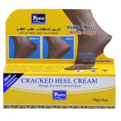 يوكو كريم Cracked Heel للأقدام 50غم