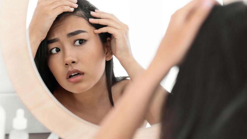 الزيت الأفغاني للصلع الوراثي ومدى فعاليته في انبات الشعر