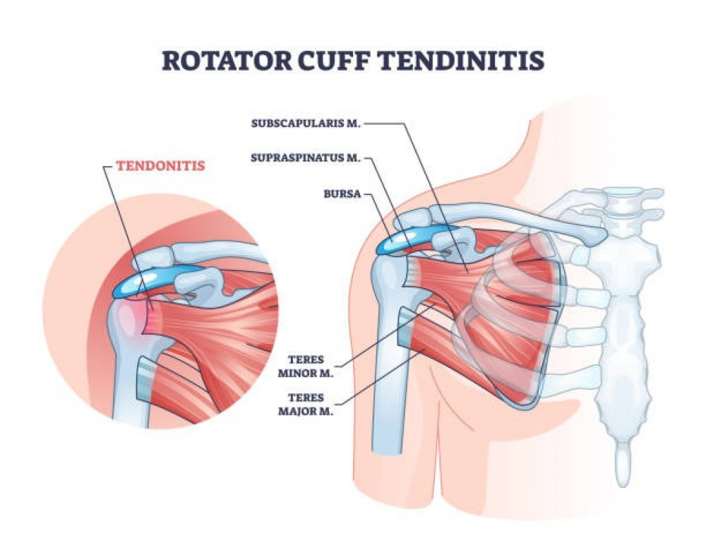 Rotator cuff