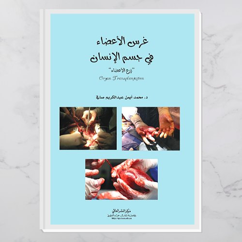غرس الأعضاء في جسم الإنسان " زرع الأعضاء"