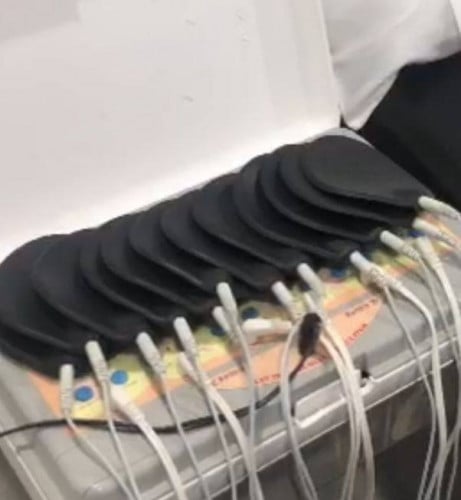 برنامج تكسير الدهون
