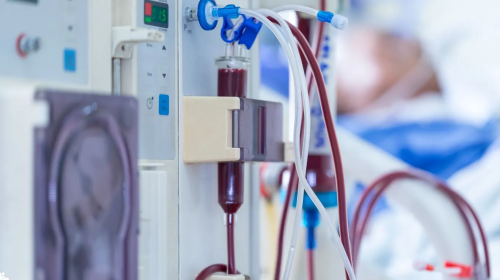 مريض بعمر 79 سنة يعاني من فشل كلوي