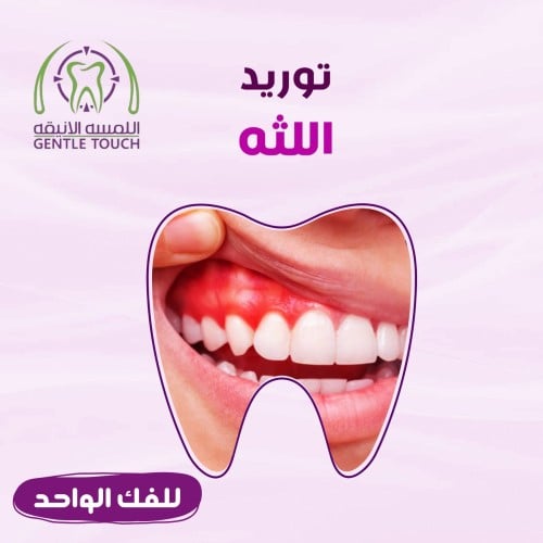 توريد لثه للفك الواحد