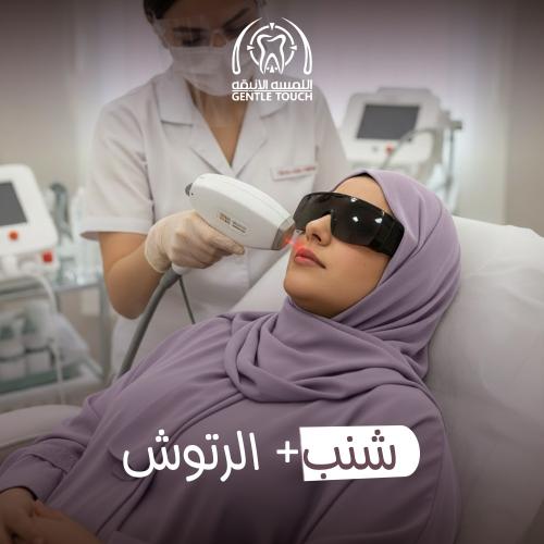 ليزر ازالة شعر الشنب مع الرتوش جهاز كانديلا