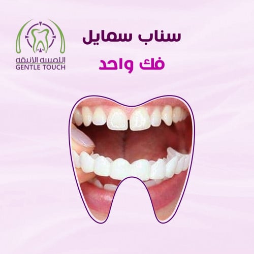 سناب سمايل للفك الواحد