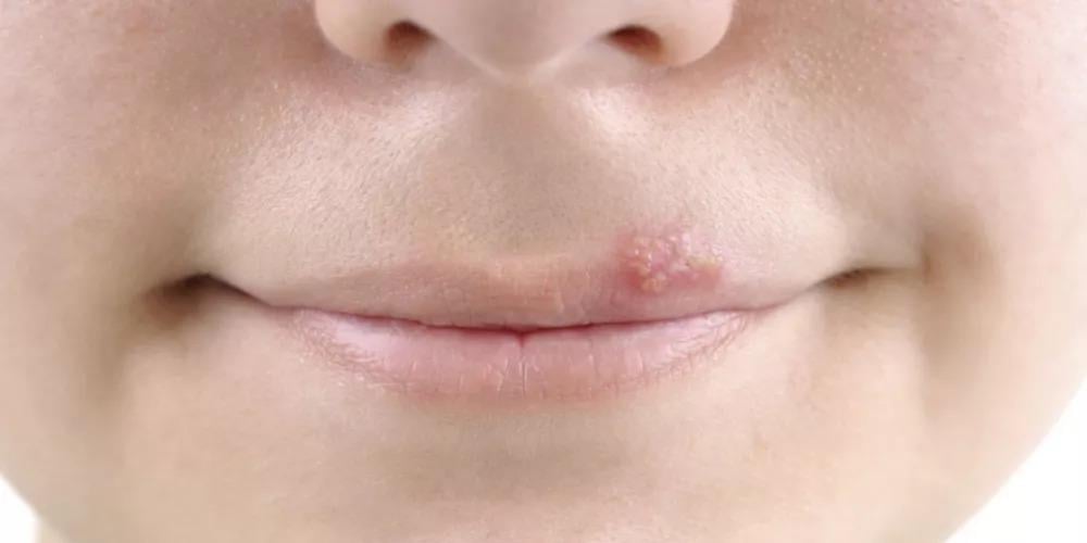 ما معنى تحليل IgG positive