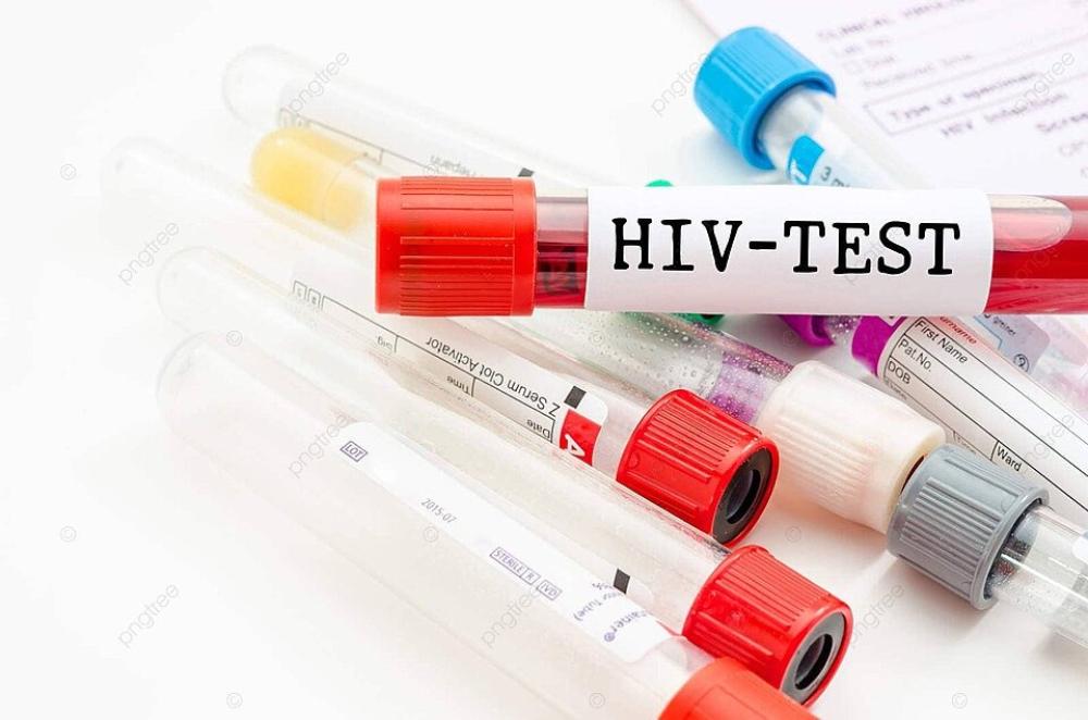 فحص مرض الإيدز في المنزل: دليل كامل لكيفية إجراء الفحص وأماكن شراء الأدوات اللازمة