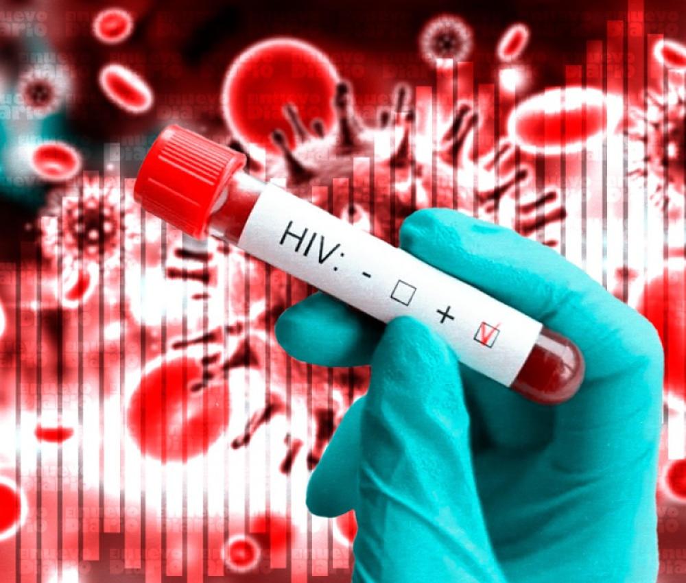 هل الممارسة السطحية تنقل الإيدز