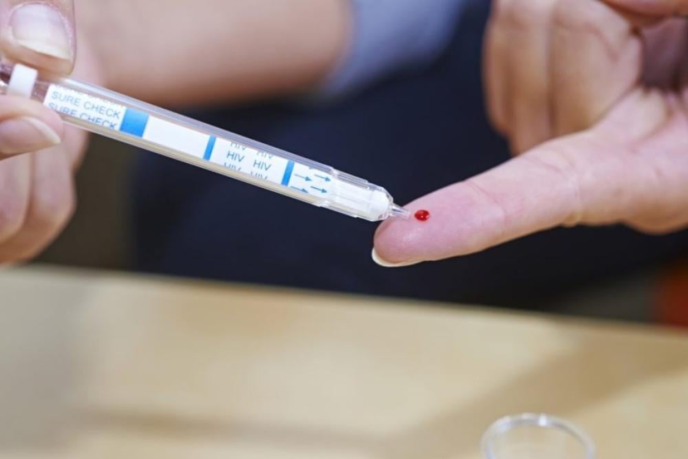 تحليل الإيدز بعد شهر: هل يعتبر قطعيًا وكيف يمكنك التأكد من دقة النتيجة؟