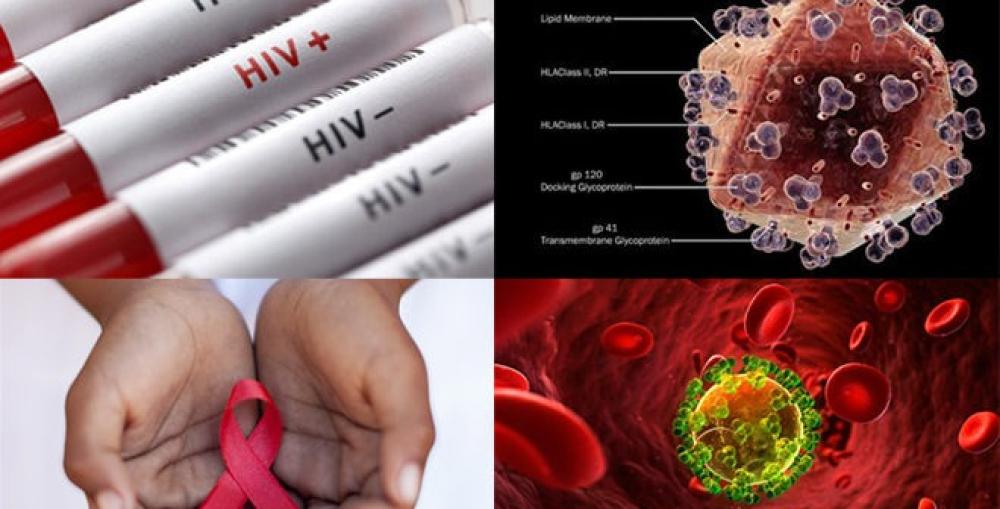هل أعراض الإيدز تظهر من أول يوم: فهم الدورة الزمنية لظهور الأعراض هل أعراض الإيدز تظهر من أول يوم: فهم الدورة الزمنية لظهور الأعراض