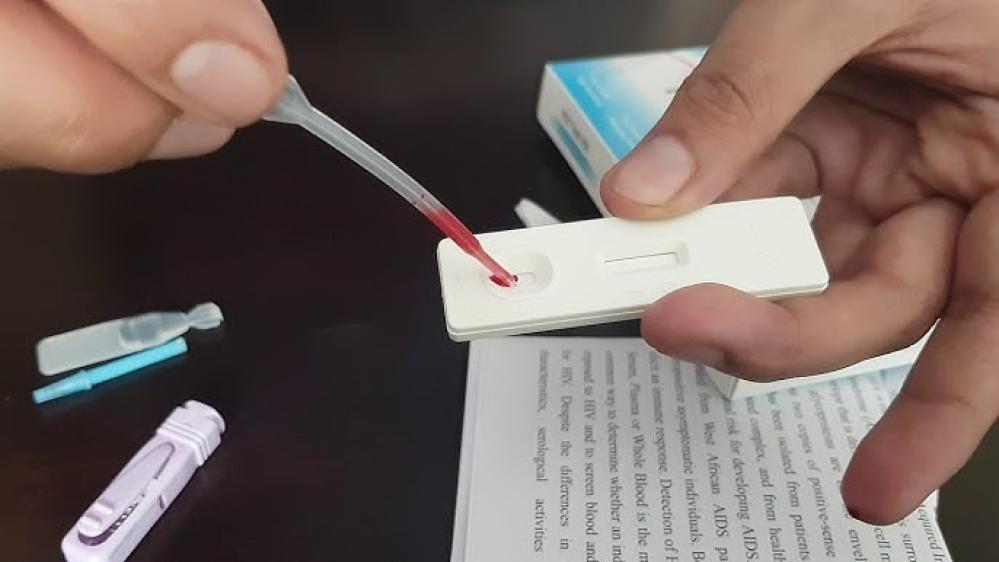 هل يوجد فحص منزلي للإيدز في السعودية؟