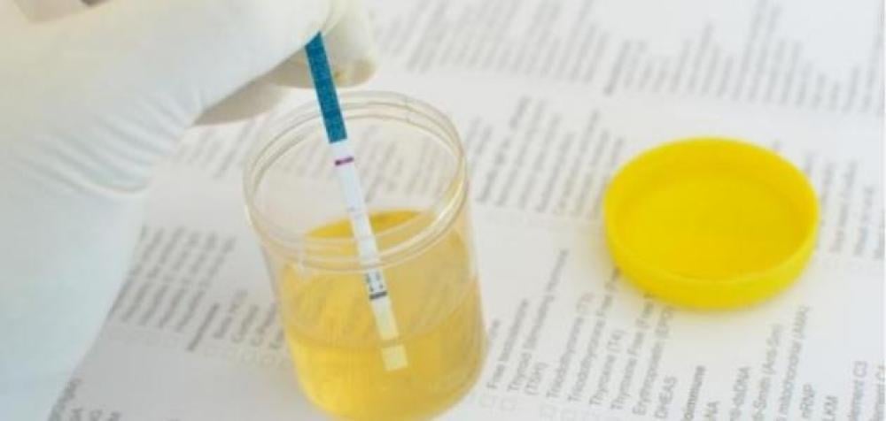 ظهور خط خفيف في اختبار المخدرات: ماذا تعني هذه النتيجة وكيفية التعامل معها؟