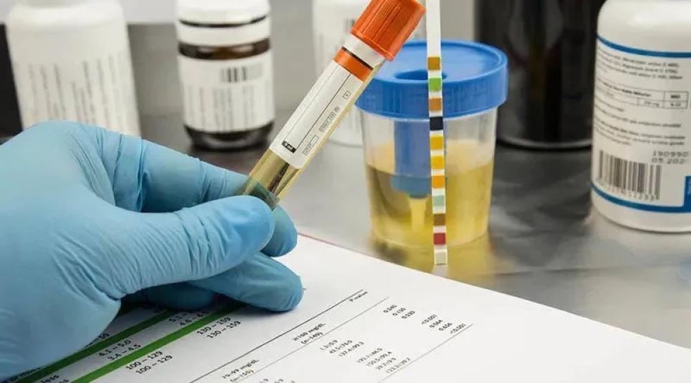 هل تحليل المخدرات يكشف عن تدخين السجائر؟ إليك الإجابة المُفصلة