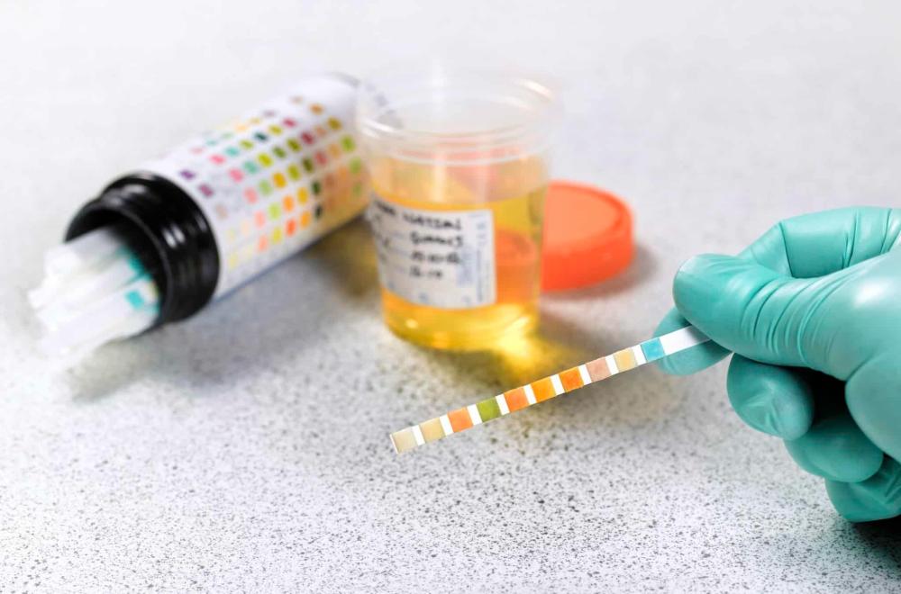 هل يظهر الحشيش في تحليل الدم بعد 90 يوما