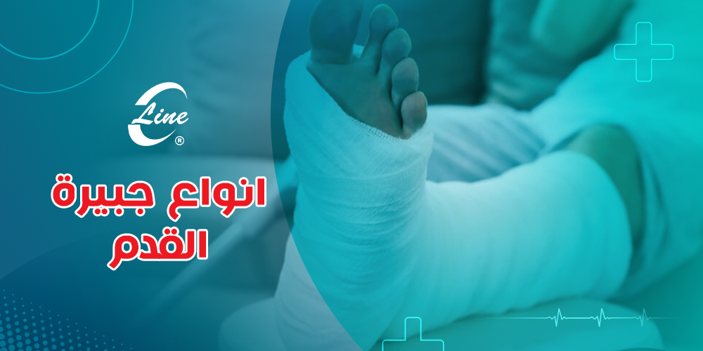 انواع جبيرة القدم
