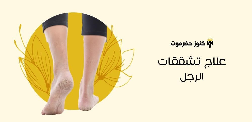 علاج تشققات الرجل