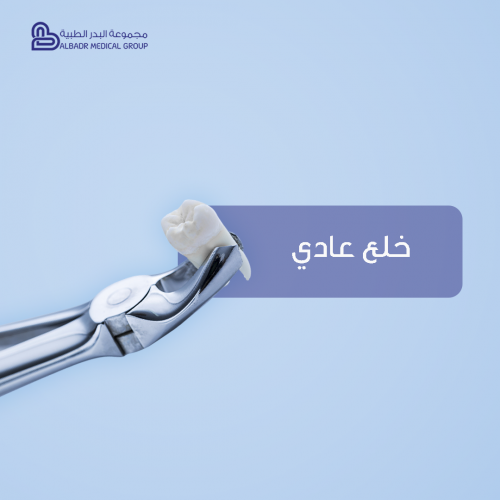خلع عادي