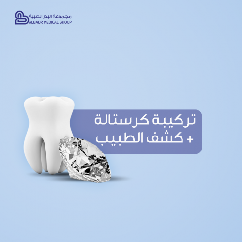 تركيب كرستالة / ماسة + كشف الطبيب