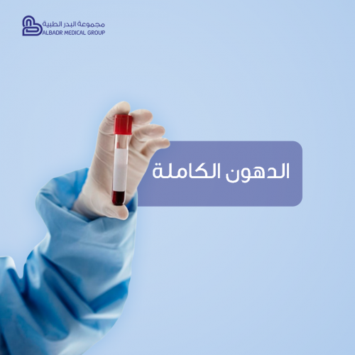 تحليل الدهون الكاملة