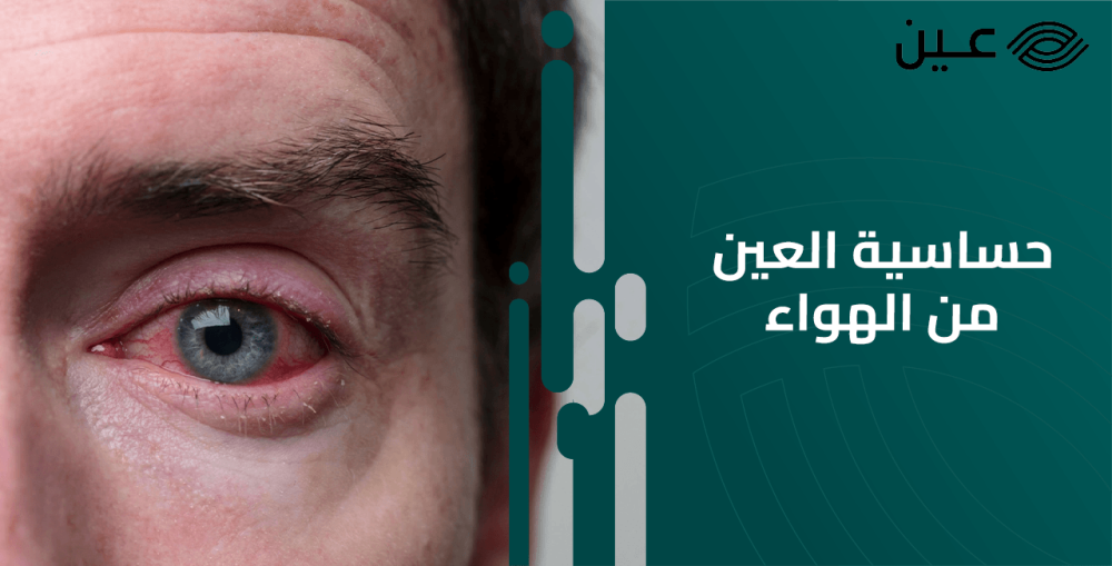 حساسية العين من الهواء: الأسباب والعلاج والنصائح للحماية