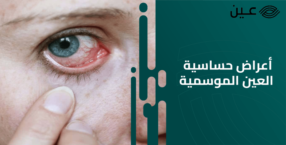 أعراض حساسية العين الموسمية