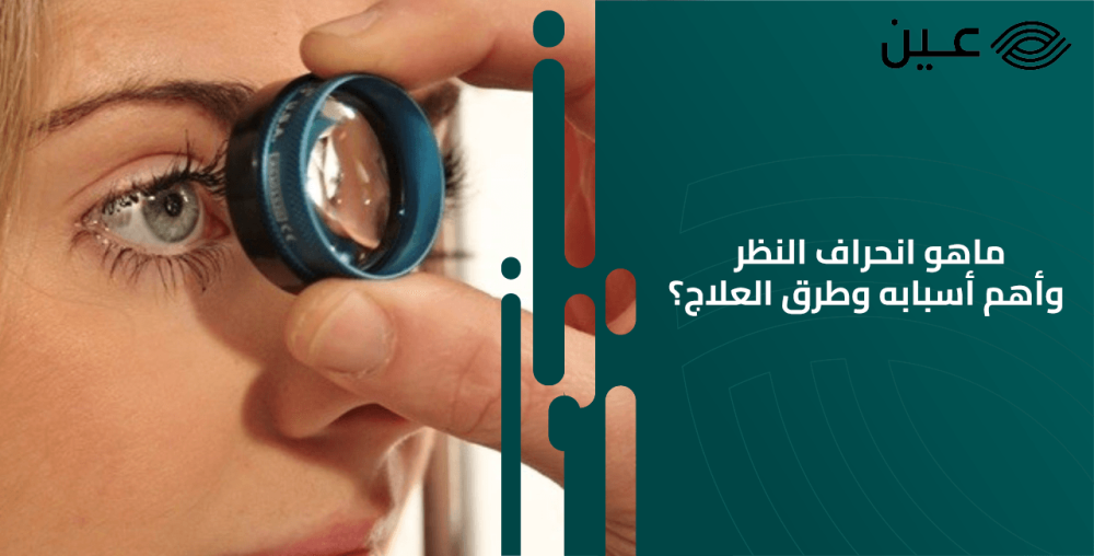 ماهو انحراف النظر وأهم أسبابه وطرق العلاج