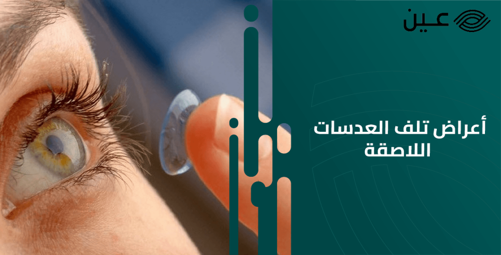 علامات تدل على أن العدسات اللاصقة غير مناسبة لكي وإنها تالفة