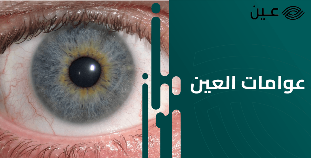 اسباب ظهور عوامات العين وكيفية التخلص منها