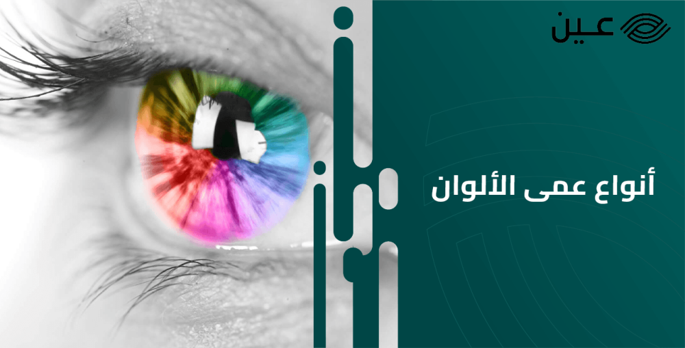 ما هو اختبار عمى الألوان وكيف يتم