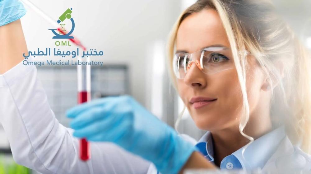 التحاليل التي تحتاج صيام