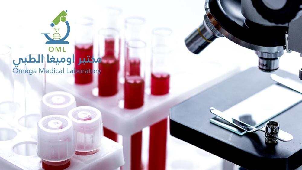متى يكون تحليل الهرمونات للنساء