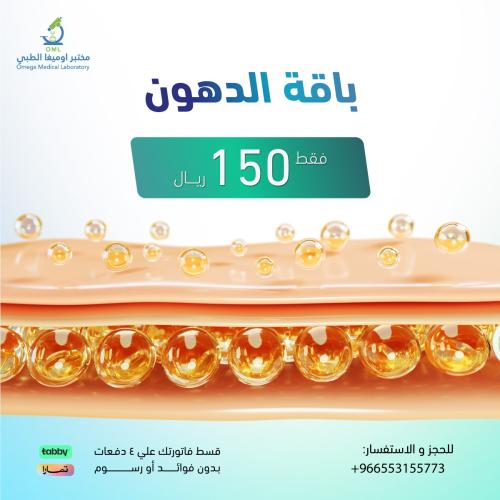 باقة الدهون