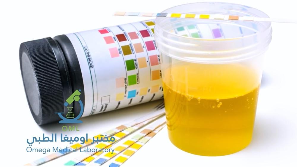 نسبة الزلال الطبيعية في البول