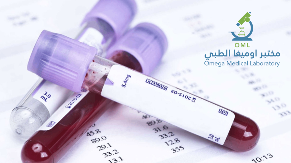 تحليل السكر صائم الطبيعي