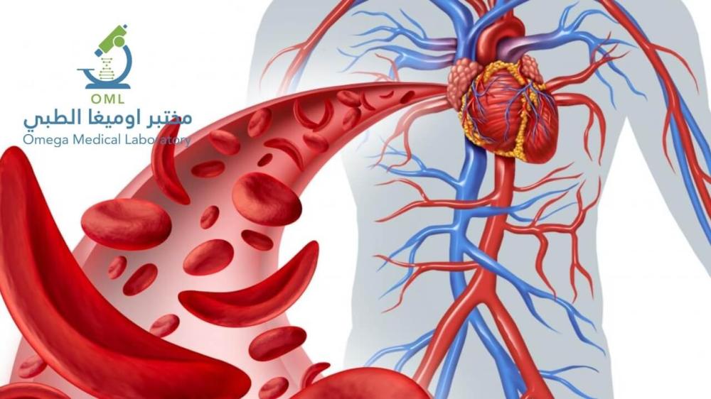 9 علامات تدل على نقص الحديد في الجسم
