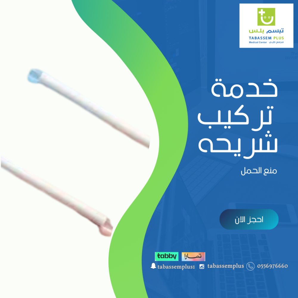 تركيب شريحة منع الحمل تبسم بلس